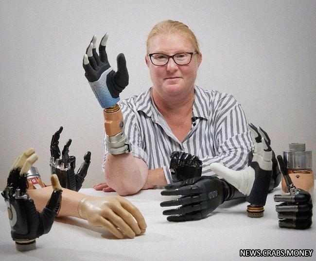 Нидерландская женщина получила экспериментальную бионическую руку, превзошедшую ожидания