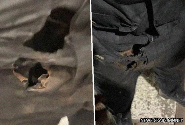 Взрыв зажигалки в кармане брюк: мужчина получил серьезные повреждения
