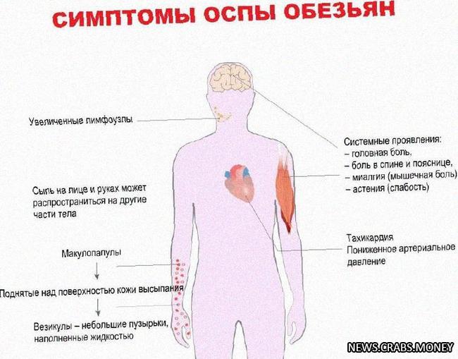 Вспышка оспы у обезьян в Таиланде: 20 новых случаев и одна смерть