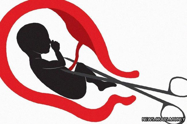Законопроект о выводе абортов из частных клиник в Госдуму в весеннюю сессию, - СМИ
