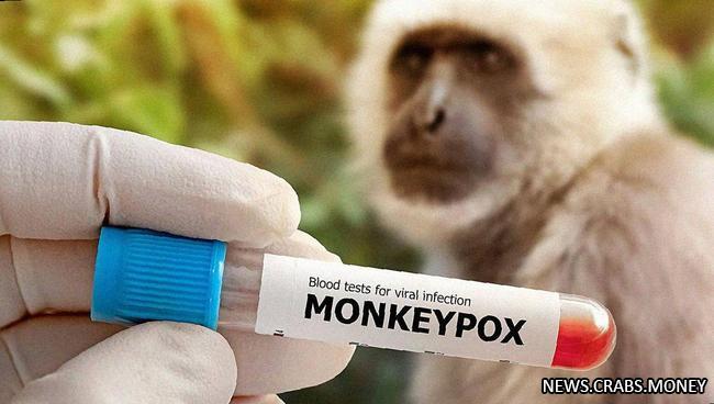 В Республике Конго объявлена эпидемия оспы обезьян